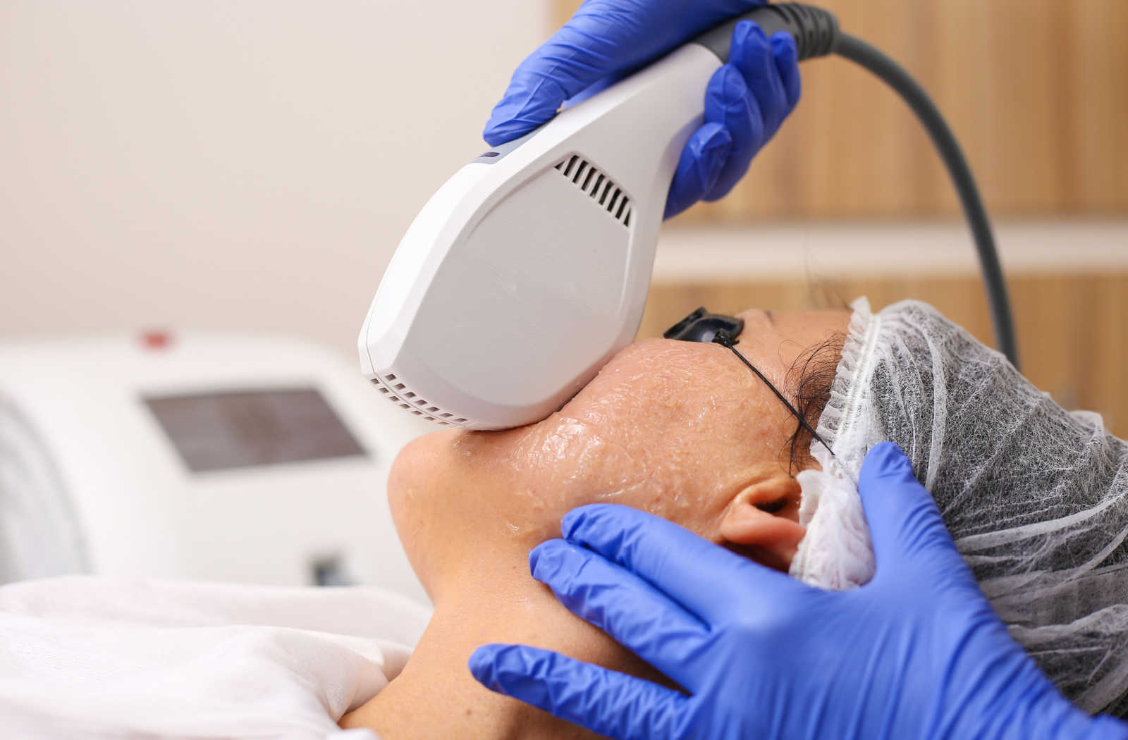 A woman at the clinic has an IPL device used on her face.