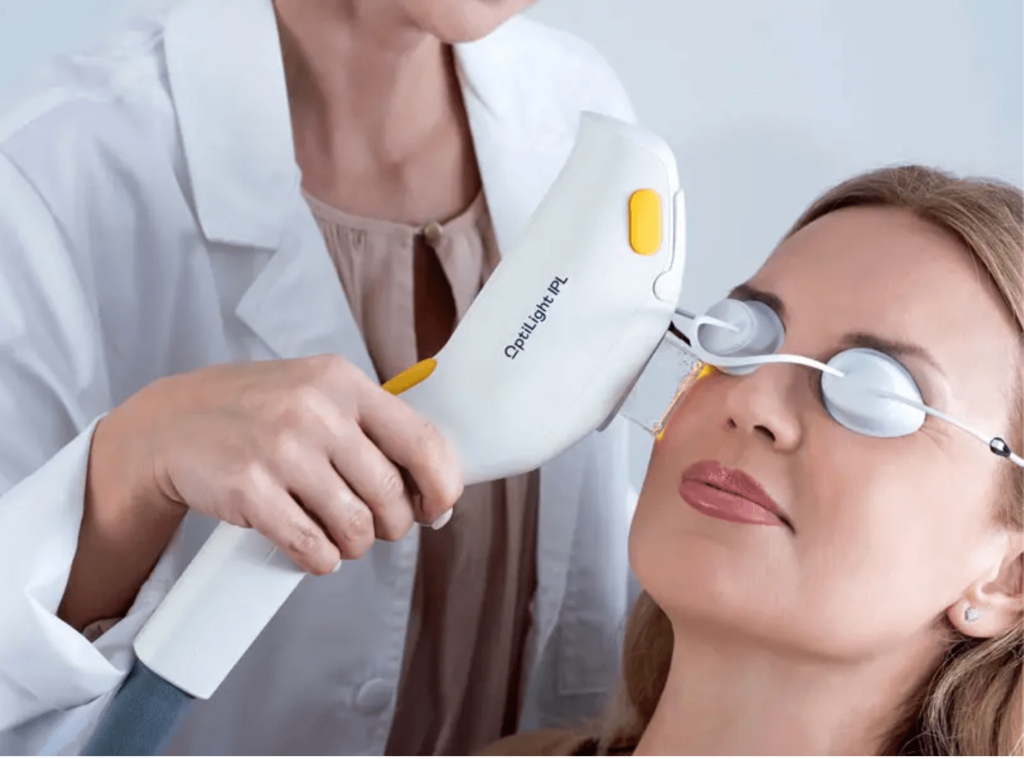 A woman being treated for dry eye with the Optilight IPL device.